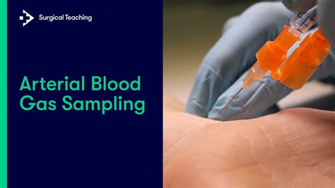Arterial Blood Gases (ABGs): Uses, Procedure, Results.